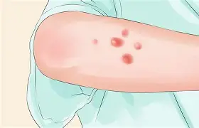 关于?墷駍4咼灻?瘑洈!晭渋鼠?|猿TV%覮f磩畚(ie的信息